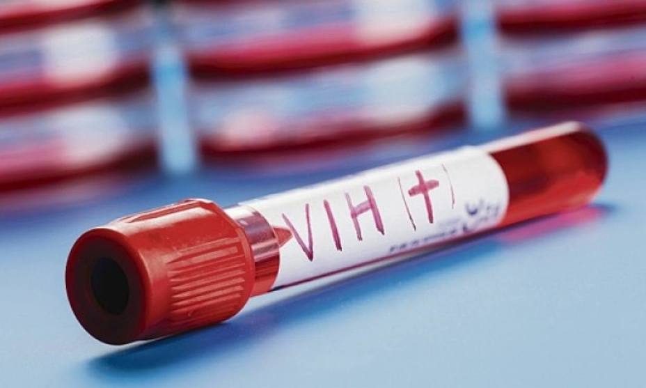 “En el día mundial de la lucha contra el VIH/sidaVenezuela continúa retrocediendo”