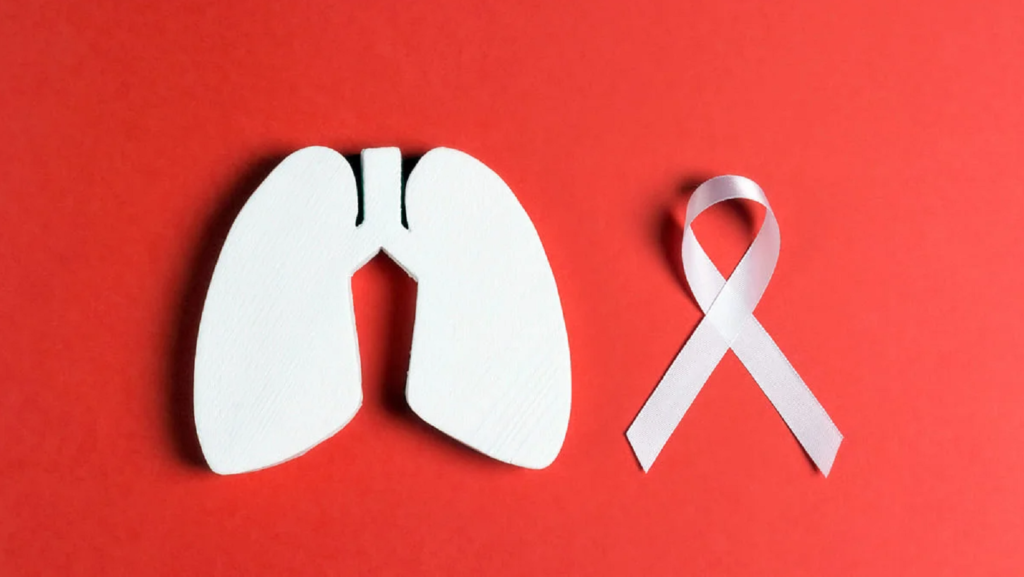 Cáncer de pulmón en Venezuela: un reto de salud que requiere acción colectiva