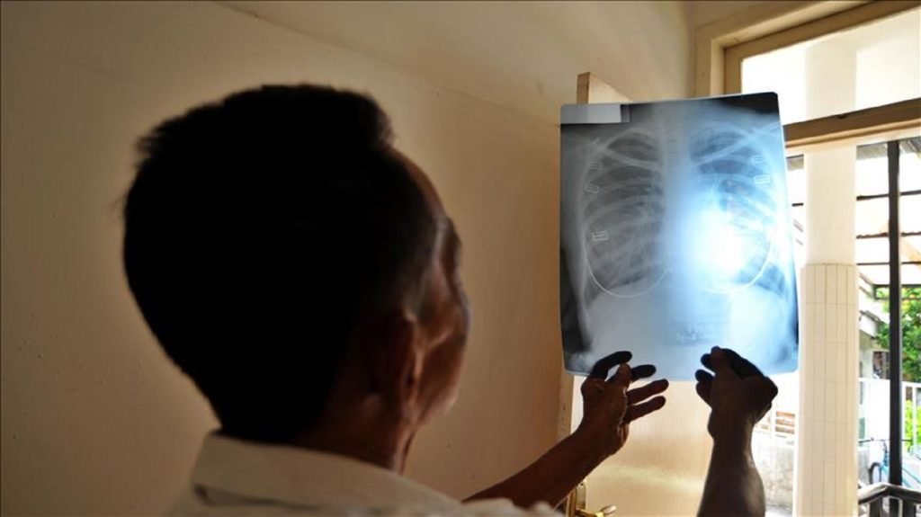 Falta de equipos de Rayos X en Venezuela: una crisis que amenaza el derecho a la salud